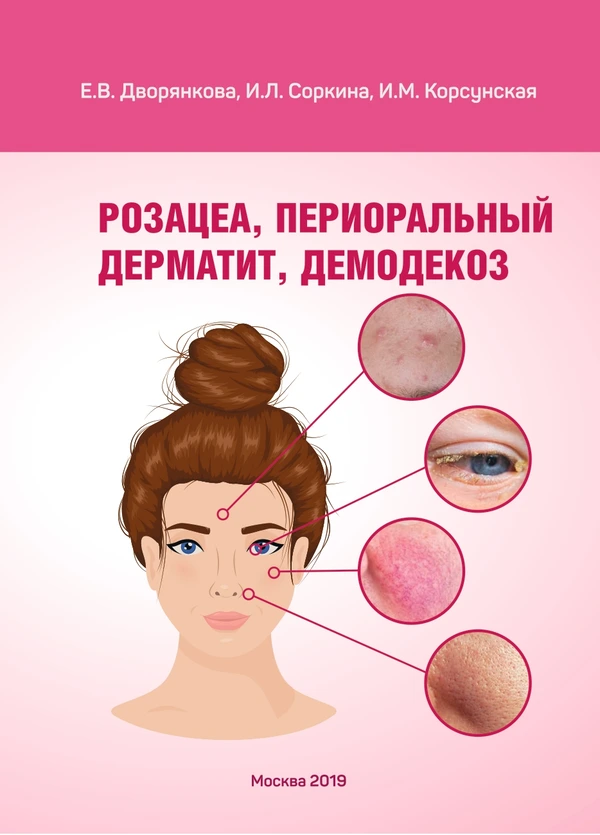 Розацеа, периоральный дерматит, демодекоз