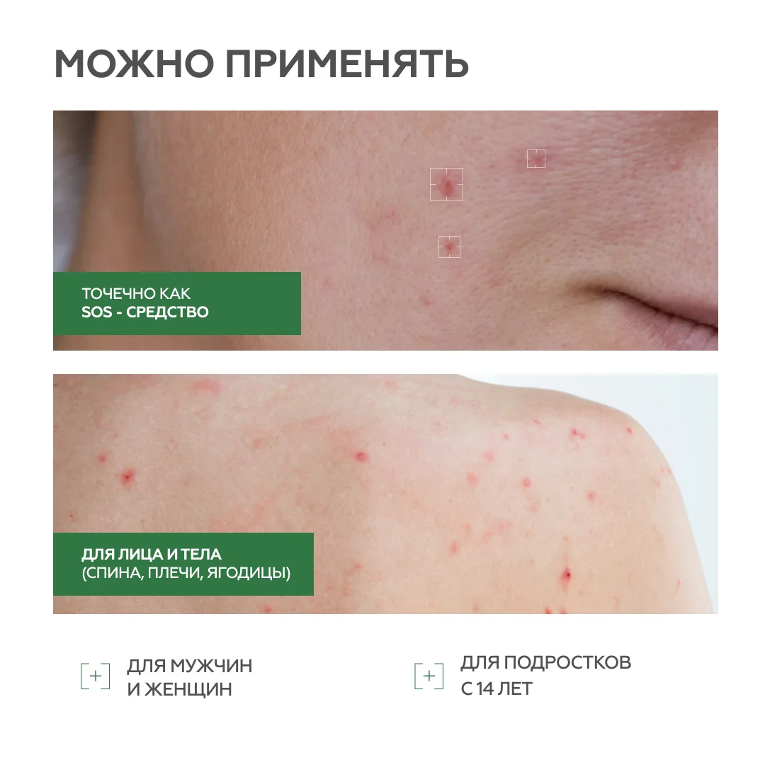 Сыворотка для проблемной кожи Blemish Control 6