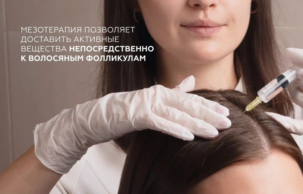 Процедура инъекционной мезотерапии кожи головы для лечения алопеции и стимуляции волосяных фолликулов