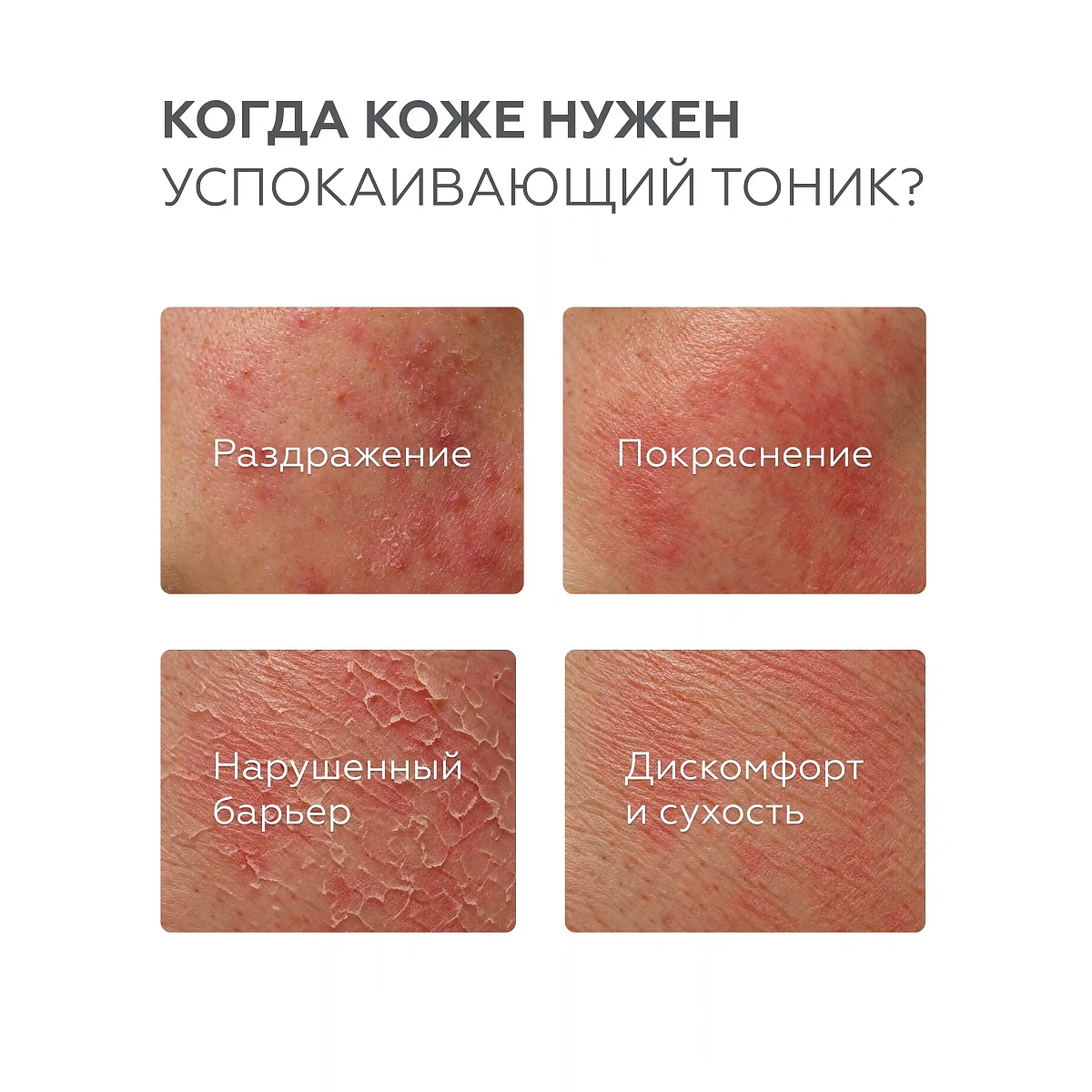 Тоник-спрей для лица Antiredness 6
